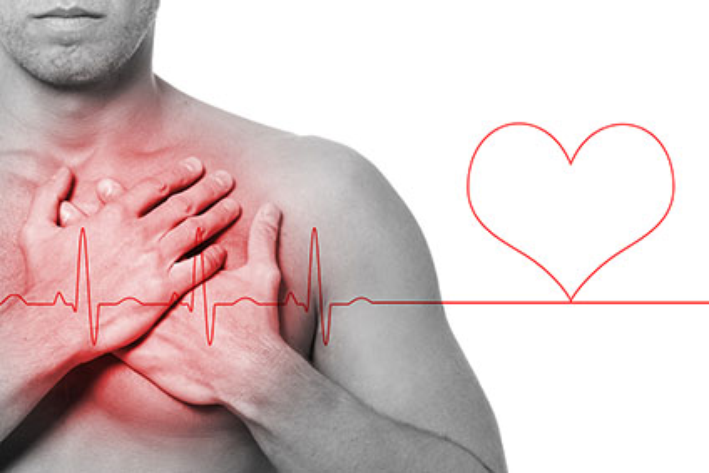 Infarto: come riconoscere i primi segnali ed evitare il peggio
