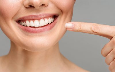 Denti più belli sostituendo l’amalgama