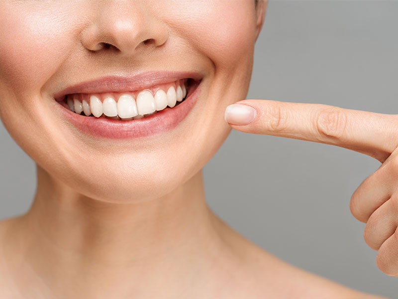 Denti più belli sostituendo l’amalgama